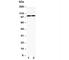 Toll Like Receptor 3 antibody, R30830, NSJ Bioreagents, Western Blot image 
