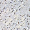 Proteasome Subunit Beta 10 antibody, 19-672, ProSci, Immunohistochemistry paraffin image 