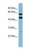 Prolyl 4-Hydroxylase, Transmembrane antibody, orb326232, Biorbyt, Western Blot image 