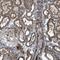 Transmembrane Protein 132C antibody, HPA015633, Atlas Antibodies, Immunohistochemistry paraffin image 