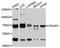Interferon Alpha And Beta Receptor Subunit 1 antibody, A10869, ABclonal Technology, Western Blot image 