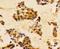 Phosphoinositide-3-Kinase Regulatory Subunit 1 antibody, A00318Y467, Boster Biological Technology, Immunohistochemistry frozen image 