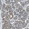Branched Chain Keto Acid Dehydrogenase Kinase antibody, PA5-53697, Invitrogen Antibodies, Immunohistochemistry paraffin image 