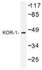 Opioid Receptor Kappa 1 antibody, AP01330PU-N, Origene, Western Blot image 