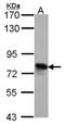 Transforming Growth Factor Beta Induced antibody, GTX100744, GeneTex, Western Blot image 