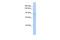 Ribosome Binding Protein 1 antibody, A07074, Boster Biological Technology, Western Blot image 