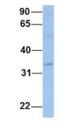 Polyamine Oxidase antibody, NBP1-70666, Novus Biologicals, Western Blot image 