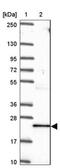 TNF Alpha Induced Protein 8 antibody, NBP2-33814, Novus Biologicals, Western Blot image 