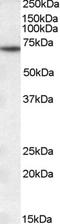 Myotubularin 1 antibody, STJ70068, St John