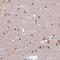 Transcription Factor AP-2 Delta antibody, PA5-61847, Invitrogen Antibodies, Immunohistochemistry paraffin image 