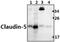 Claudin 5 antibody, GTX49370, GeneTex, Western Blot image 
