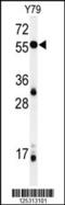 NIN1 (RPN12) Binding Protein 1 Homolog antibody, 61-677, ProSci, Western Blot image 