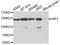 Huntingtin Interacting Protein 1 antibody, orb247678, Biorbyt, Western Blot image 