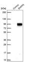 Ectonucleotide Pyrophosphatase/Phosphodiesterase Family Member 5 antibody, PA5-53515, Invitrogen Antibodies, Western Blot image 