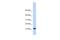 Transmembrane Protein 254 antibody, A17416, Boster Biological Technology, Western Blot image 