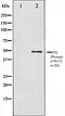 Fibroblast Growth Factor Receptor 1 antibody, orb106046, Biorbyt, Western Blot image 