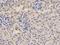 Protein Tyrosine Phosphatase Non-Receptor Type 6 antibody, orb136200, Biorbyt, Immunohistochemistry paraffin image 
