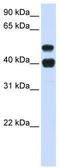 Ubiquitin Specific Peptidase 22 antibody, TA344369, Origene, Western Blot image 