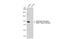 Androgen Receptor antibody, GTX135345, GeneTex, Western Blot image 