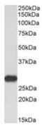 Latexin antibody, NB100-57856, Novus Biologicals, Western Blot image 