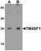 Transmembrane 4 L Six Family Member 1 antibody, PA5-21119, Invitrogen Antibodies, Western Blot image 