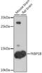 FKBP Prolyl Isomerase 1B antibody, A08125, Boster Biological Technology, Western Blot image 