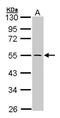 Integrin Linked Kinase antibody, PA5-28571, Invitrogen Antibodies, Western Blot image 