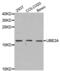 Ubiquitin-conjugating enzyme E2 A antibody, abx001827, Abbexa, Western Blot image 