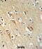 ALG10 Alpha-1,2-Glucosyltransferase antibody, abx034589, Abbexa, Immunohistochemistry frozen image 