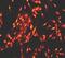 Neurotrophic Receptor Tyrosine Kinase 1 antibody, ab76291, Abcam, Immunocytochemistry image 