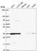 Deoxyribose-Phosphate Aldolase antibody, HPA055897, Atlas Antibodies, Western Blot image 