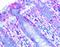 MLX Interacting Protein Like antibody, NB400-135B, Novus Biologicals, Immunohistochemistry paraffin image 