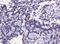 Catenin Delta 1 antibody, NBP2-45646, Novus Biologicals, Immunohistochemistry frozen image 
