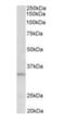 Peptidase Inhibitor 15 antibody, orb12386, Biorbyt, Western Blot image 