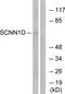 Sodium Channel Epithelial 1 Delta Subunit antibody, TA314516, Origene, Western Blot image 
