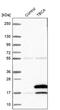 Tubulin Folding Cofactor A antibody, PA5-57683, Invitrogen Antibodies, Western Blot image 