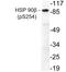 Heat Shock Protein 90 Alpha Family Class B Member 1 antibody, LS-C192179, Lifespan Biosciences, Western Blot image 