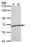 Zinc Finger Protein 223 antibody, GTX108781, GeneTex, Western Blot image 
