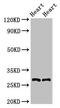 Myogenic factor 5 antibody, LS-C670731, Lifespan Biosciences, Western Blot image 