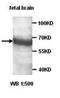 ADAM Metallopeptidase Domain 29 antibody, orb77014, Biorbyt, Western Blot image 