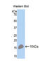 TNF Receptor Superfamily Member 17 antibody, LS-C300285, Lifespan Biosciences, Western Blot image 