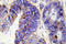 Collagen Type IV Alpha 2 Chain antibody, LS-C176967, Lifespan Biosciences, Immunohistochemistry paraffin image 