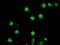 Tribbles Pseudokinase 2 antibody, MA5-24942, Invitrogen Antibodies, Immunocytochemistry image 