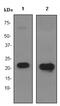Crystallin Alpha B antibody, ab76467, Abcam, Western Blot image 
