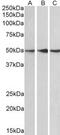 Protein Phosphatase 2 Regulatory Subunit B'Epsilon antibody, MBS420815, MyBioSource, Western Blot image 