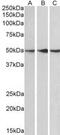 Protein Phosphatase 2 Regulatory Subunit B'Epsilon antibody, MBS420815, MyBioSource, Western Blot image 