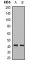 C-C Motif Chemokine Receptor 8 antibody, abx225082, Abbexa, Western Blot image 