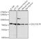 Interleukin 7 Receptor antibody, GTX54311, GeneTex, Western Blot image 