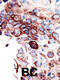 AXL Receptor Tyrosine Kinase antibody, 63-030, ProSci, Immunohistochemistry paraffin image 