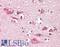 Phospholipase C Gamma 1 antibody, LS-B7825, Lifespan Biosciences, Immunohistochemistry frozen image 